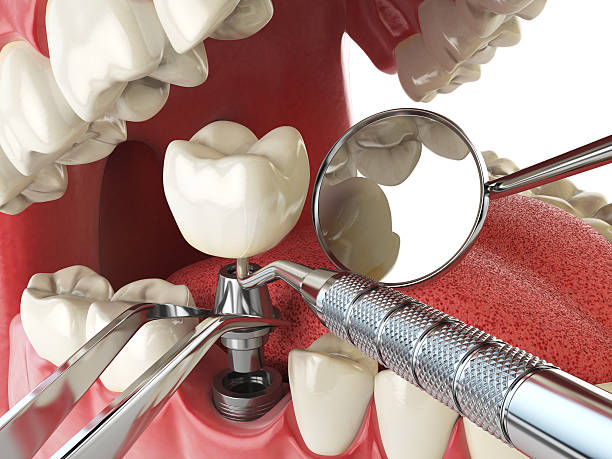 Best Emergency Root Canal Therapy in Swifton, AR
